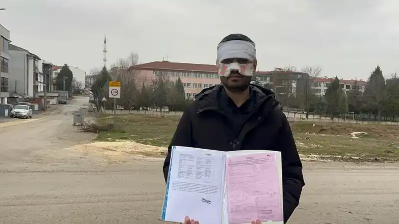 Sıcak Çay İle Yaşanan Skandal: Öğretmen Öğretmeni Yaktı!