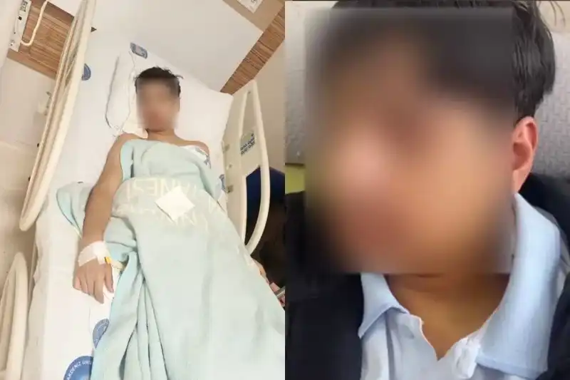 Antalya'da Akran Zorbalığı Vakası: Arkadaşının Çenesini Kırdı